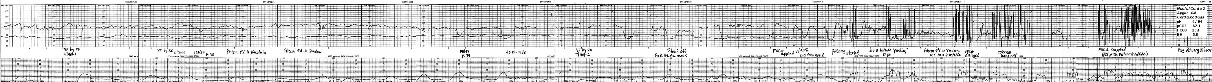 Electronic Fetal Heart Monitoring - Brookside Associates Medical