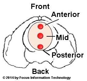 Cervical position illustration in pelvis