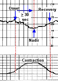 Stress Test Heart Rate Chart