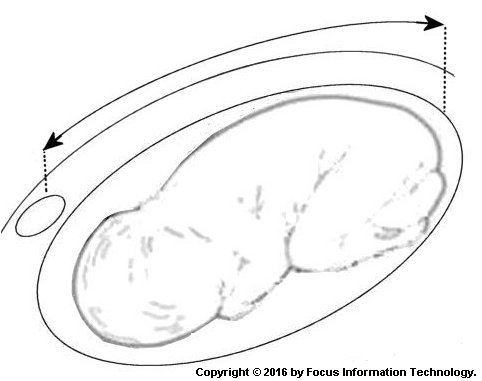 Measuring symphysis–fundal height