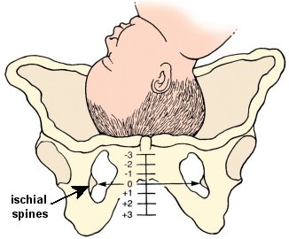 Fetal station diagram
